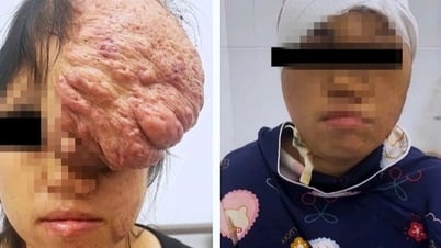 HCMC: Dringende Rettung für 2 Frauen mit bösartigen Tumoren im Darm und Schädel