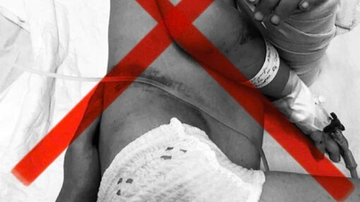 Cảnh báo lừa đảo trên mạng xã hội về trường hợp bé Đỗ Minh Khoa