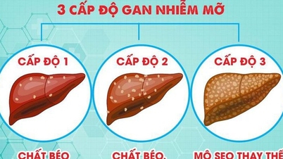 Hai cách đơn giản giúp bảo vệ gan khỏe mạnh mỗi ngày