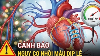 Nguy cơ nhồi máu cơ tim dịp lễ, cuối năm tăng mạnh