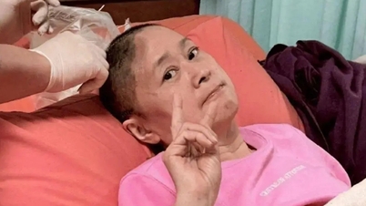 Diễn viên 'Vườn sao băng' ngã chấn thương, mất một phần hộp sọ