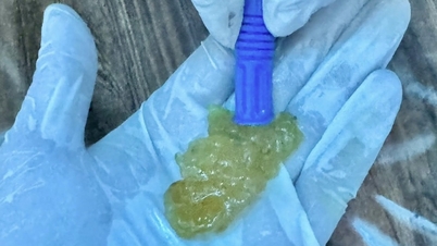 مدينة هو تشي منه: رجل مسن يدخل في غيبوبة ويعاني من سكتة قلبية بعد أن اختنق بفطائر الأرز اللزج.