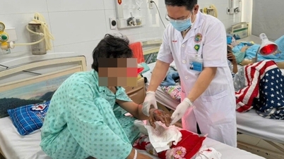 구조대원들이 전기톱에 손이 거의 잘려나간 남성 작업자의 손을 구조해냈다.
