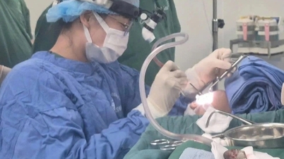 Una cuchara de plástico entra en las vías respiratorias de un niño de más de 4 años.