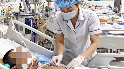 Hombre en estado crítico tras automedicarse y recibir líquidos intravenosos para tratar la varicela.