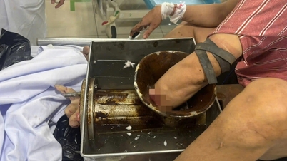 Kota Ho Chi Minh: Seorang pria mengalami kecelakaan tragis di pabrik pengolahan daging babi cincang.