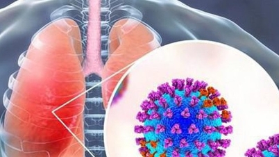 Berapa lamakah tempoh inkubasi untuk virus respiratori syncytial (RSV) dalam kalangan kanak-kanak, dan bagaimana ia boleh dicegah?