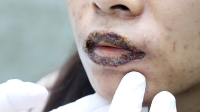 Muchas personas terminan perdiendo dinero y sufriendo consecuencias negativas por tratamientos de belleza rápidos.
