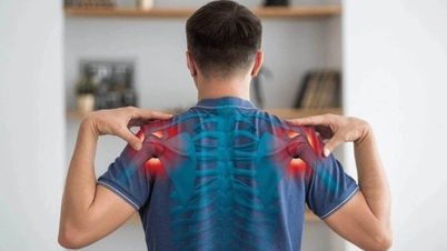 Levantar el brazo causa dolor; tenga cuidado con la tendinitis y los daños en los tejidos blandos.