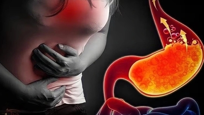 Bí mật giúp dạ dày tránh bị axit của chính nó ăn mòn