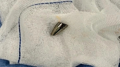 Mens en 7 år gammel gutt studerte, falt pennespissen ned i luftveiene hans.