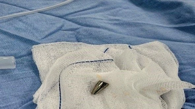 Lékaři okamžitě zachránili život sedmiletému dítěti, které se udusilo hrotem pera, jenž se jí zasekl v dýchacích cestách.