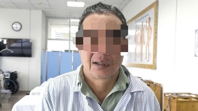 ایک دم تندرست، اگلا منہ سردی کی وجہ سے بگڑ گیا۔