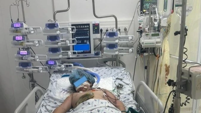 Salvando la vida de una joven con raras laceraciones en la piel causadas por un accidente de tránsito.