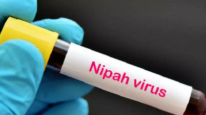 Ministerstwo Zdrowia udostępnia informacje na temat epidemii wirusa Nipah i środków zapobiegawczych.