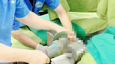 Người đàn ông nhập viện với bàn tay nằm trong máy xay thịt