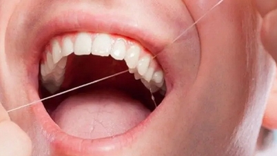 O igienă orală bună ajută la prevenirea multor boli periculoase.