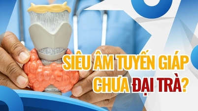 Mengapa USG tiroid umum dilakukan tetapi belum banyak direkomendasikan?