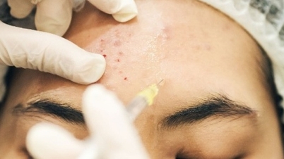 Fast-tracked beauty treatments for Tet (Lunar New Year) are no longer uncommon, and complications are becoming increasingly likely.