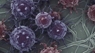 Research on 36 types of cancer reveals the top 3 risk factors.