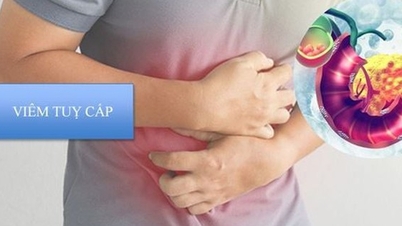 Tenga cuidado con la pancreatitis aguda después de una comida abundante.