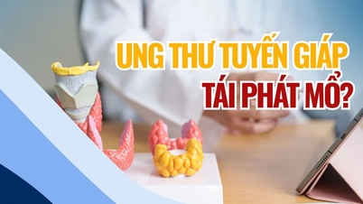 Tiroid kanserinin tekrarlama riskini hafife almayın.