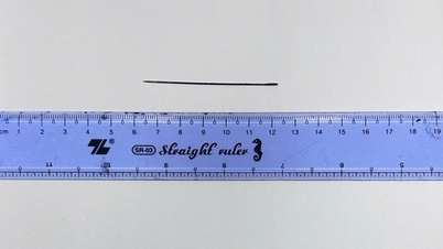 Autoritățile au reușit să extragă un ac de cusut lung de 6 cm din ficatul unui bărbat.