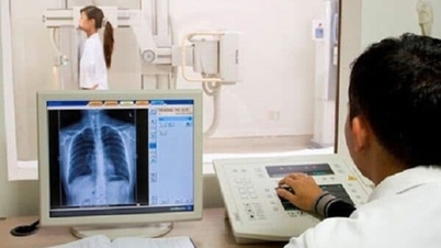Le ministère de la Santé demande une modification de la politique selon laquelle les radiographies d'une durée inférieure à 6 minutes ne sont pas prises en charge par l'assurance maladie.