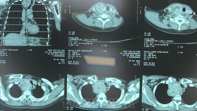 Imagistica diagnostică fără filme imprimate este acoperită de Fondul de asigurări de sănătate.