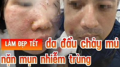Rostos assimétricos, pele queimada de sol – muitas mulheres quase arruinaram suas comemorações do Ano Novo Lunar por causa de tratamentos de beleza rápidos.