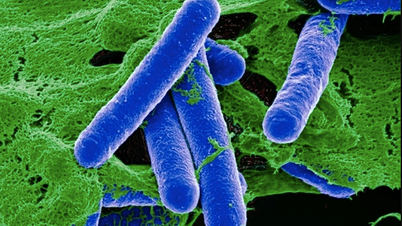El Ministerio de Salud advierte sobre toxinas ‘neurotóxicas’ en alimentos fermentados y enlatados.