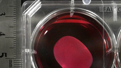 Des experts expriment leurs inquiétudes concernant le médicament révolutionnaire à base de cellules souches développé au Japon.