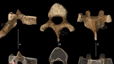 The oldest recorded cases of cancer date back 1.7 million years to ancient humans.