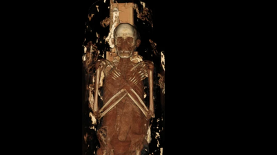 Les scanners CT révèlent l'apparence et la pathologie des momies de l'Égypte antique.