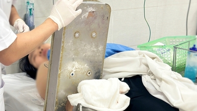 The woman was hospitalized with her hand still stuck in a meat grinder.