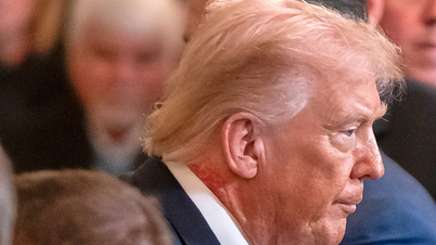 Лікар Білого дому розповідає про помітну червону пляму на шиї Трампа.