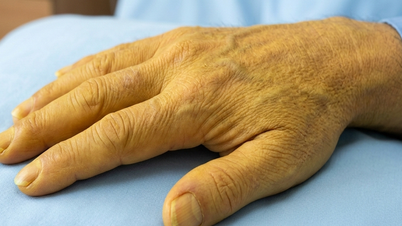 3 simptome hepatice care semnalează riscuri care pun viața în pericol.