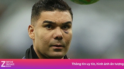 لماذا عين كاسيميرو مصابة بكدمة؟