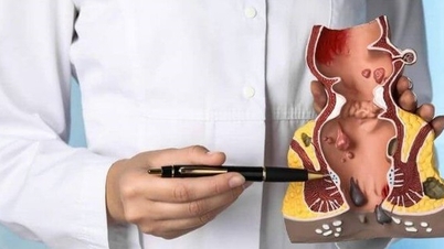 Hemorrhoidal bleeding: Don't underestimate the risk of serious blood loss.
