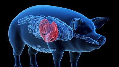 Door een varkenslever aan een bloedvat in het been te koppelen, werd het leven gered van een man die op een orgaantransplantatie wachtte.