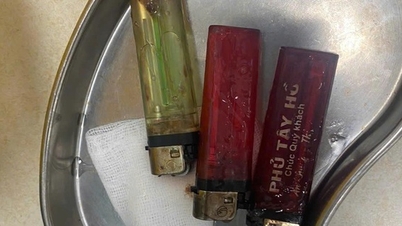 Trois briquets ont été retrouvés dans l'estomac du jeune homme.