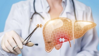 Yếu tố nguy cơ làm tăng tỷ lệ mắc ung thư gan
