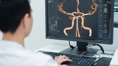 Bližší pohled na první vietnamský „superstroj“ MRI 3.0.