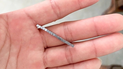 Meerdere magneten gevonden in de buik van een 5-jarig kind.