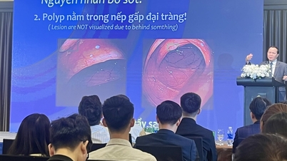 Eksperter bemerker risikoen for at kreft blir oversett under gastrointestinal endoskopi.