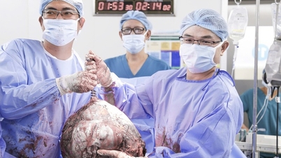 Une femme de 25 ans, présentant un ventre anormalement volumineux, a découvert qu'elle avait des fibromes utérins pesant près de 12 kg.