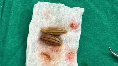 Elderly woman suffers rectal perforation after swallowing loquat seed.