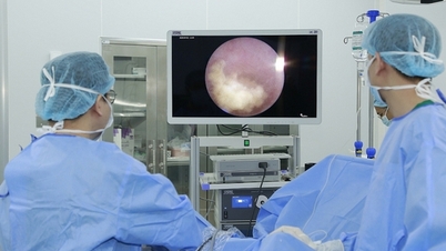 New non-surgical technology shortens kidney stone treatment time to 24 hours.