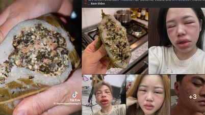 Kue telur semut sedang menjadi tren online: Beberapa orang telah dirawat di rumah sakit karena reaksi alergi, siapa yang sebaiknya menghindarinya?
