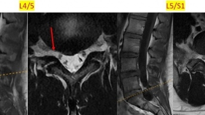 A 25-year-old man went to the doctor for lower back pain and discovered a series of musculoskeletal problems.
